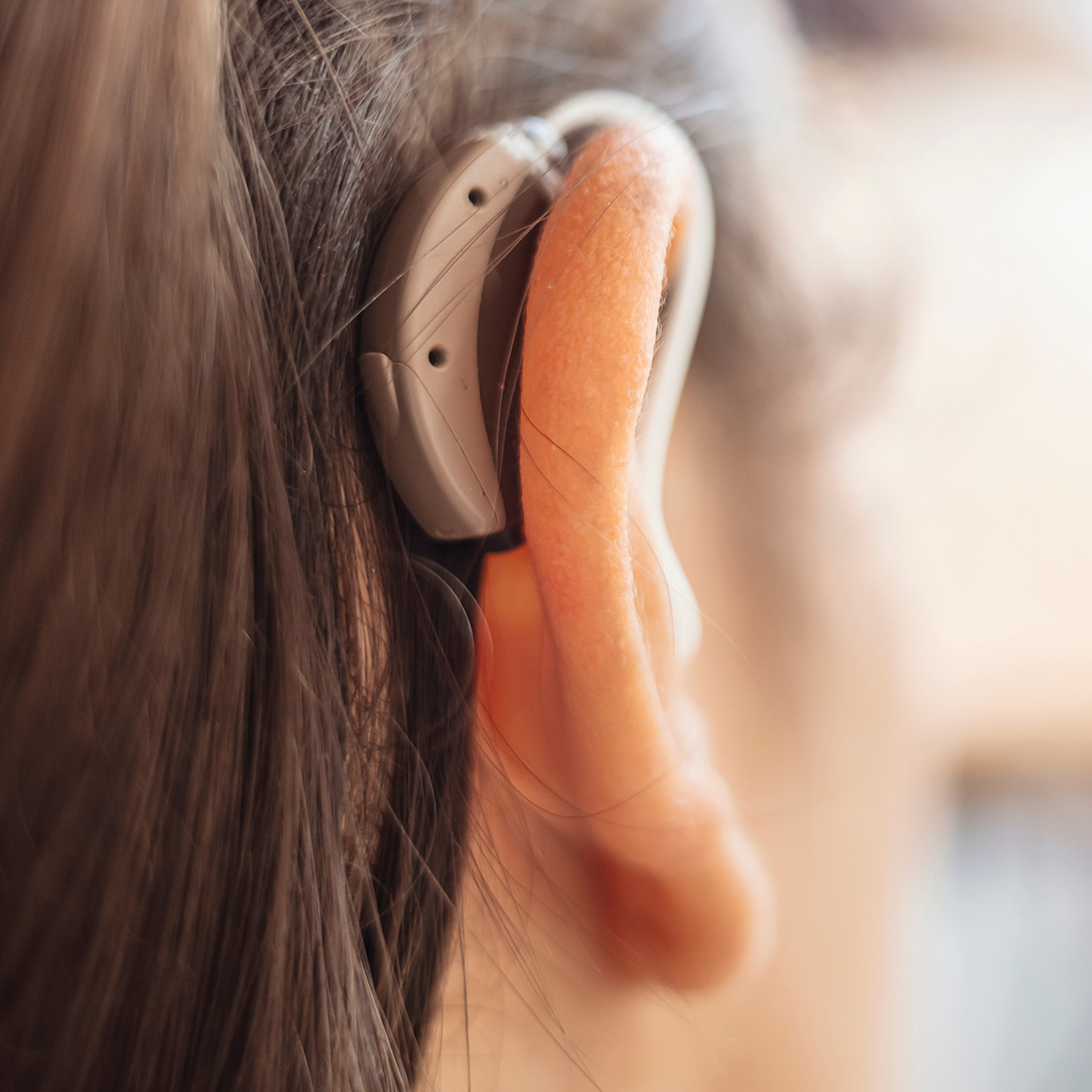 Hinter-dem-Ohr-Hörgerät (HdO) Hinter-dem-Ohr-Hörgerät (HdO)